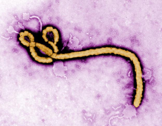 Primeiro caso de Ebola transmitido sexualmente